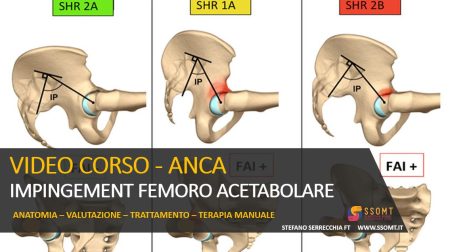 VIDEO CORSO - ANCA IMPINGEMENT FEMORO ACETABOLARE