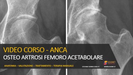 VIDEO CORSO - ANCA OSTEO ARTROSI FEMORO ACETABOLARE