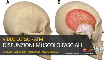 VIDEO CORSO - ATM DISFUNZIONI MUSCOLO FASCIALI